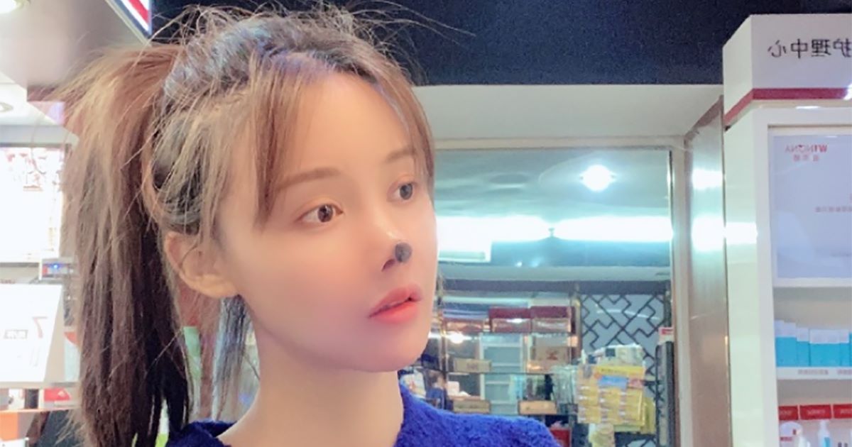 合併症で命を落とす人も…整形しすぎて人生が変わってしまった人3選